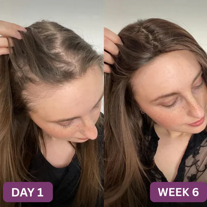 My Veromy® Hair Growth Accelerator